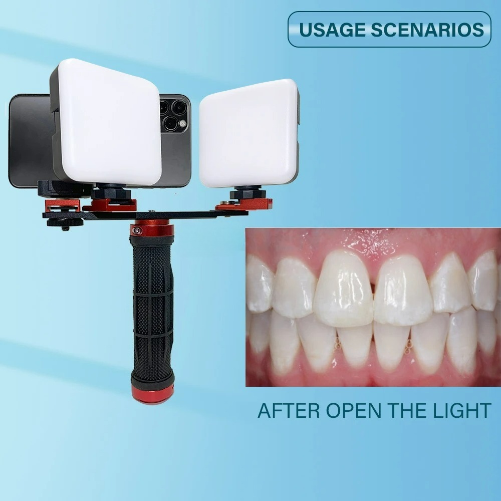 Dental Photography Light Phone - Photography Lighting Accessories recensie en prijs