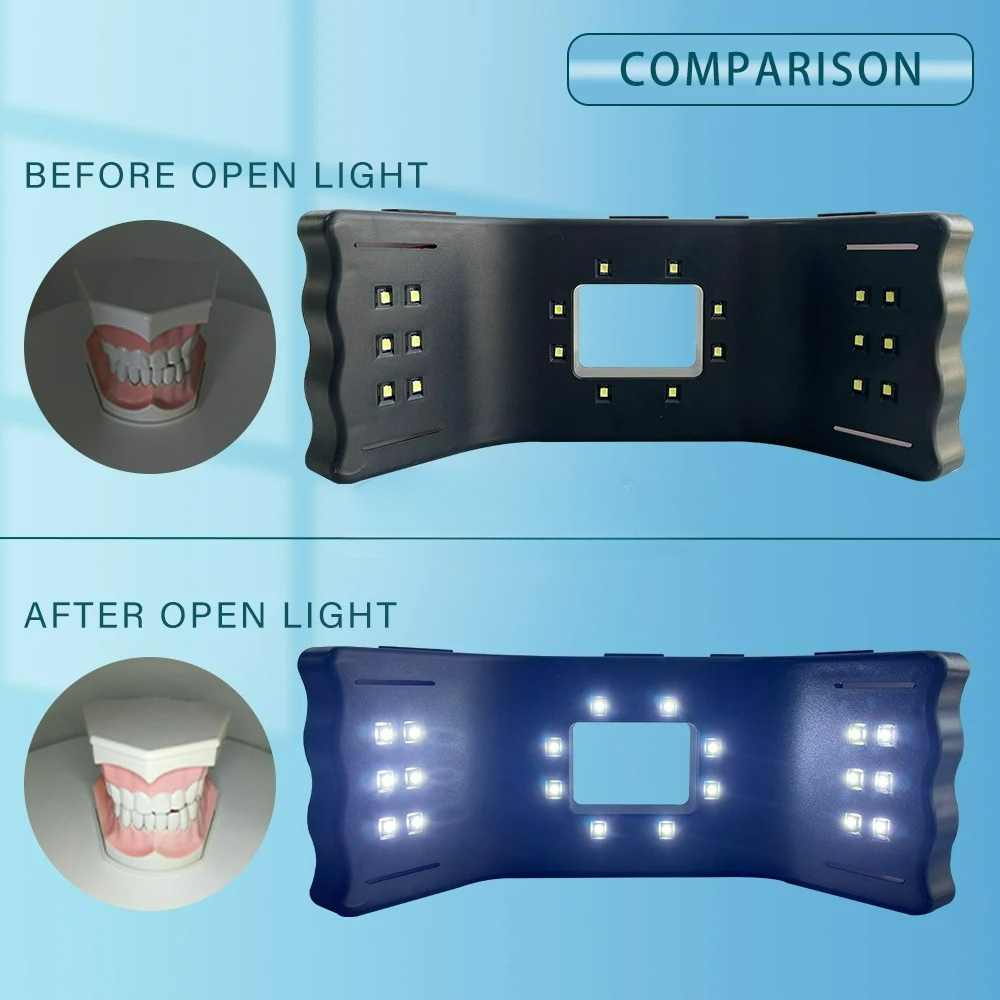 Dental Photography Light Phone - Photography Lighting Accessories recensie en prijs