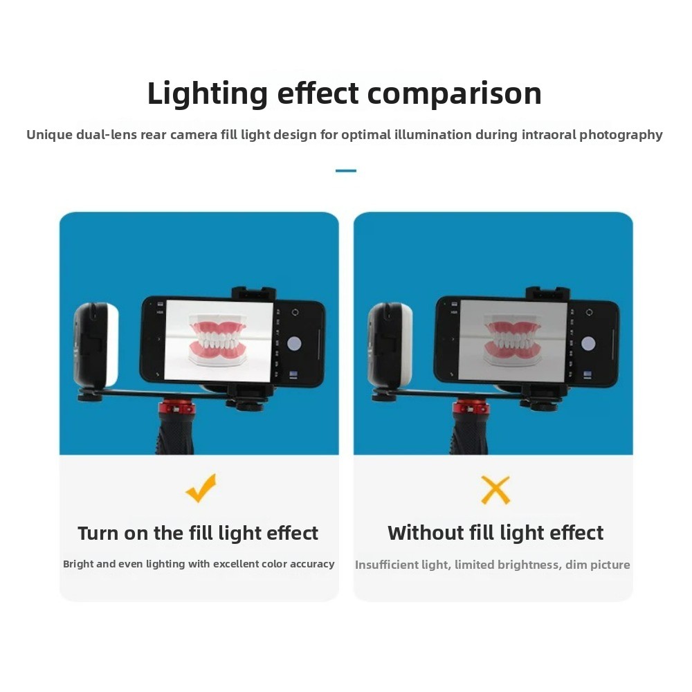 Dental Photography Light, Blue - Photography Lighting Portable recensie en prijs